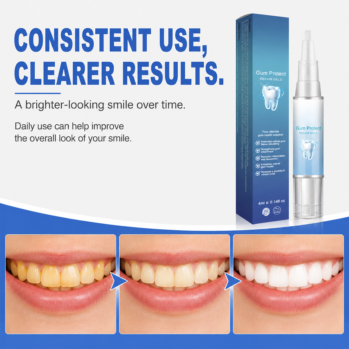 🎐Gum Protect & Repair Gel – Gum Protection and Repair Gel