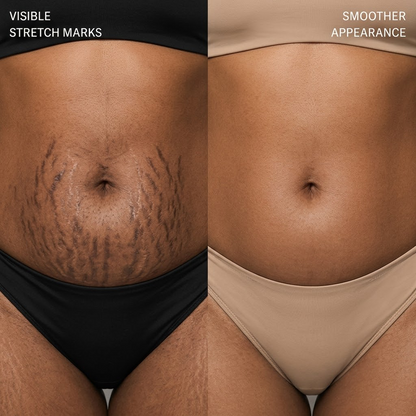SCAR REMOVAL CREAM