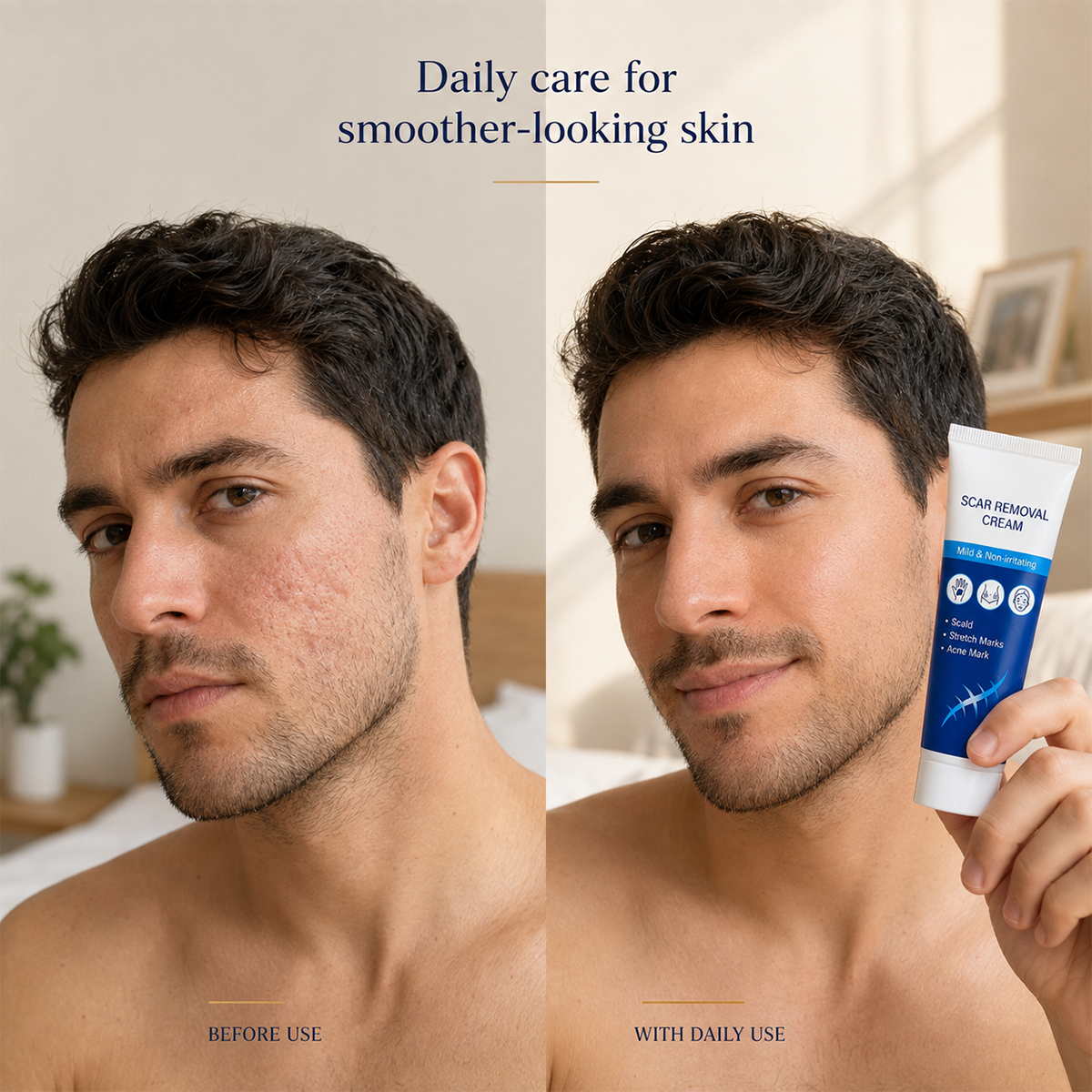 SCAR REMOVAL CREAM