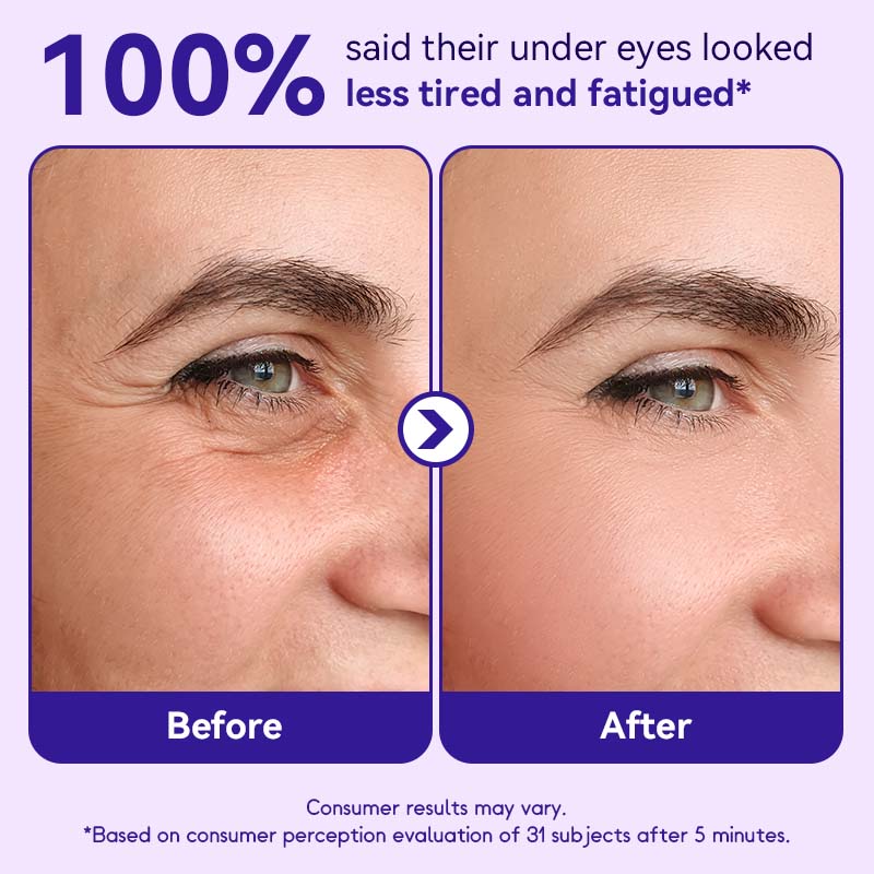 Instant Lift Eye Gel — Reduce the Look of Eye Bags in Minutes