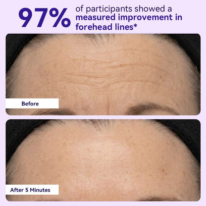 Instant Lift Eye Gel — Reduce the Look of Eye Bags in Minutes