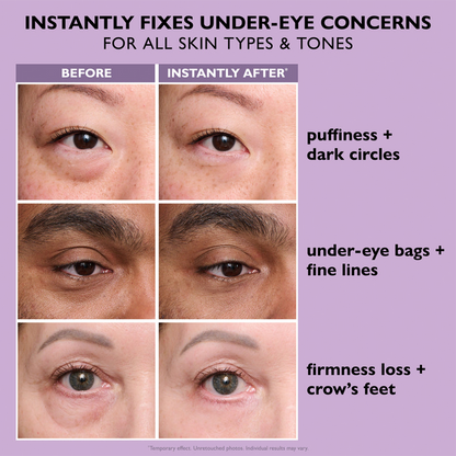 Instant Lift Eye Gel — Reduce the Look of Eye Bags in Minutes