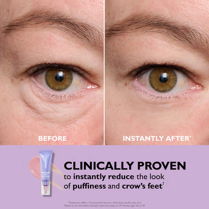 Instant Lift Eye Gel — Reduce the Look of Eye Bags in Minutes