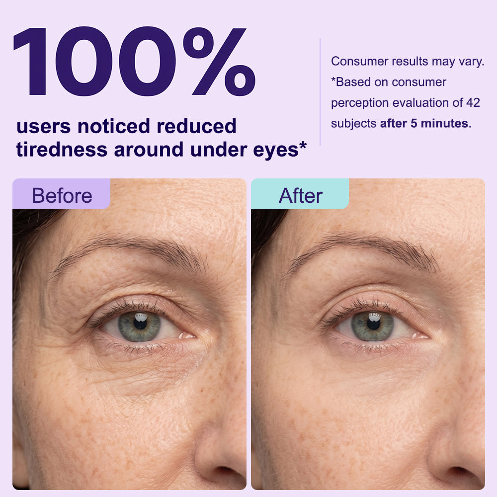 Instant Lift Eye Gel — Reduce the Look of Eye Bags in Minutes