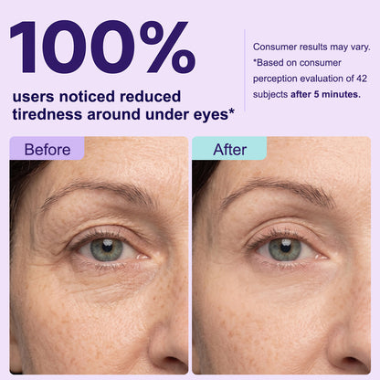 Instant Lift Eye Gel — Reduce the Look of Eye Bags in Minutes