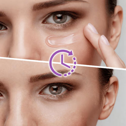 Instant Lift Eye Gel — Reduce the Look of Eye Bags in Minutes