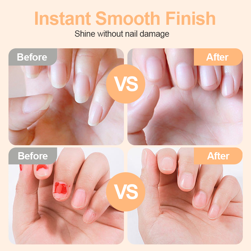 🌟2-in-1 Safe Electric Nail Clipper⚡